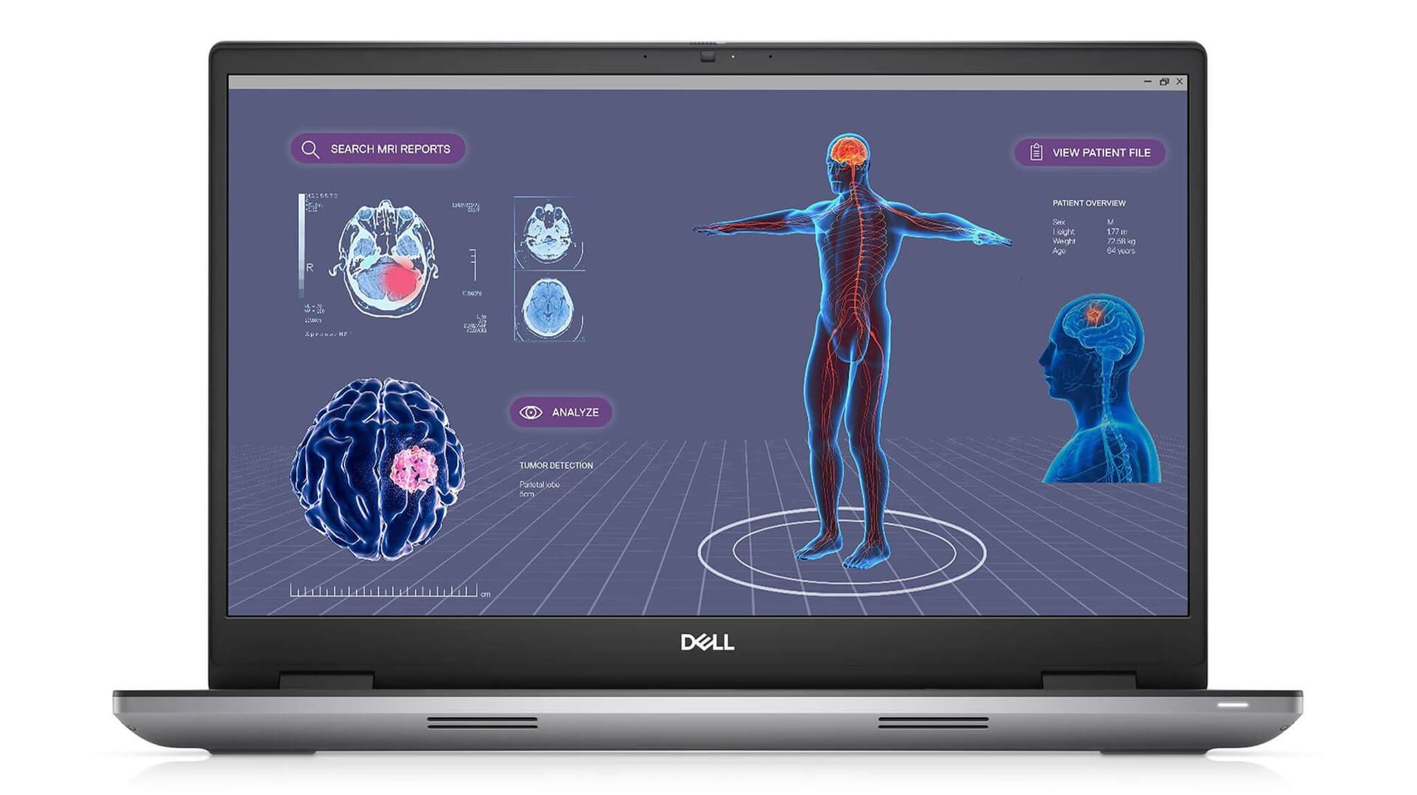 DELL Precision 7780 (2023) - Workstation Hiệu Năng Cao - màn hình hiển thị đồ họa y tế